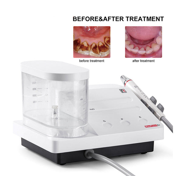 Correct use of transparent scaler