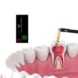 Dental Wireless Endo Motor Built-in Apex Locator Oral Therapy Equipment Accessory Endodontic Rotary Root Canal Instrument